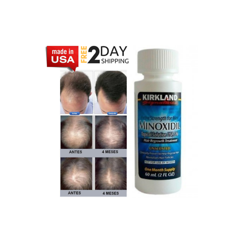 Minoxidil 5% Kirkland